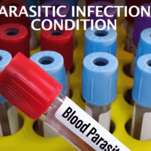 Parasitic Infections Condition