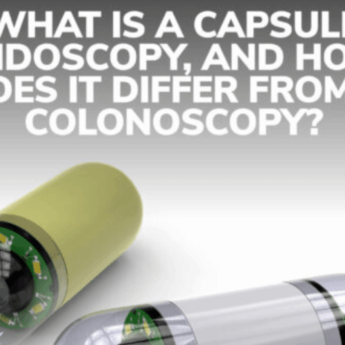 Capsule Endoscopy