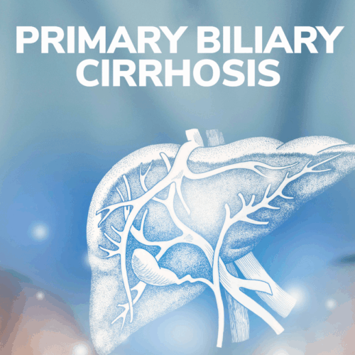 Primary Biliary Cirrhosis