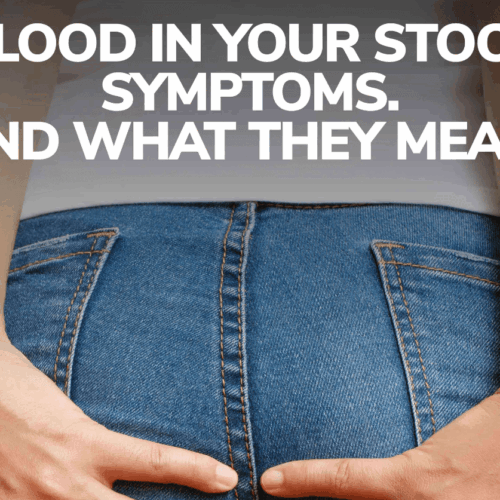 Blood In Your Stool