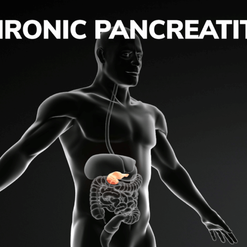 chronic pancreatitis