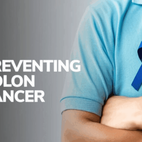 Preventing Colon Cancer