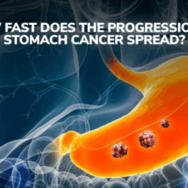 stomach cancer