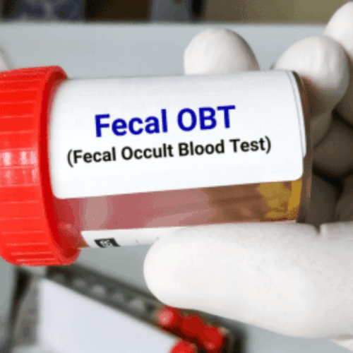 fecal obt blood test