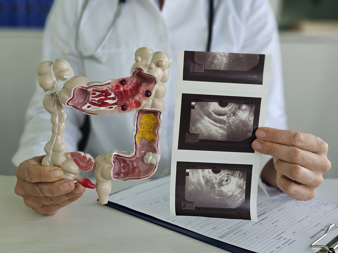 Close Up Photo of Digestive System and Upper Endoscopic Ultrasound