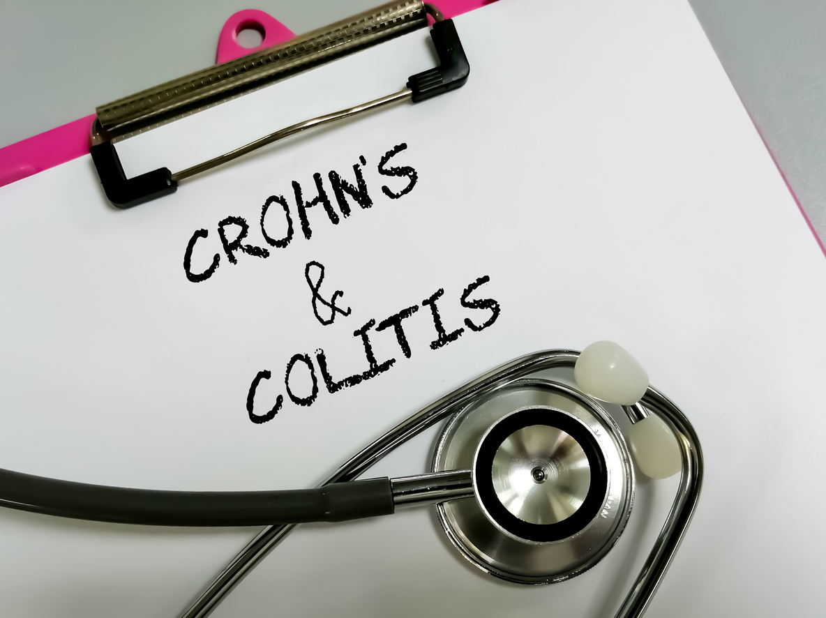 Crohn's and colitis text isolated with stethoscope on a clip board, white background